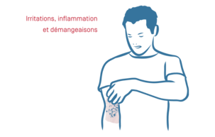 Eczéma Atopique - 03