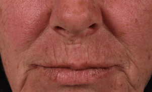 Résultat Anti-âge serum photo 1