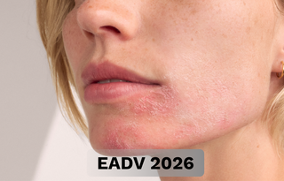EADV 2026 - CARDS-ADERMA.