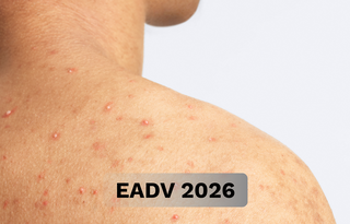 EADV 2026 - CARDS - DUCRAY- ACNE