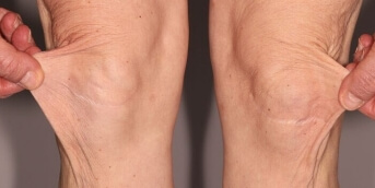 leg