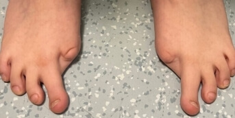pied