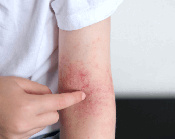 EADV 2025 - posters DA