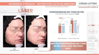 Proven post-laser efficacy