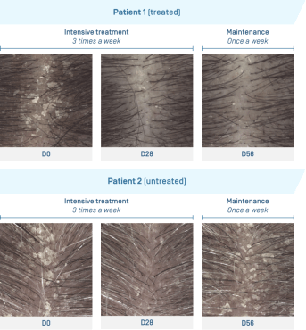 EN-Kertyol shp · Photos illustratives.png