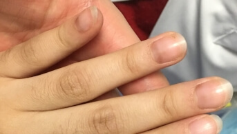 Curieuse pigmentation ungéale