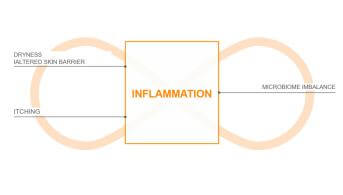 Visuel eczema