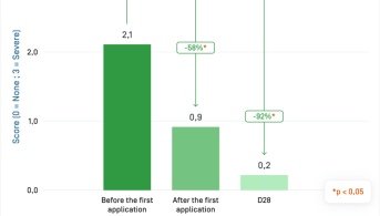 EN-Sensinol Lait · Xerose.png