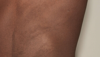 asymétrie 2
