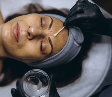 visuel peeling fiche conseil