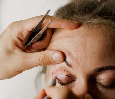 visuel blépharoplastie fiche conseil